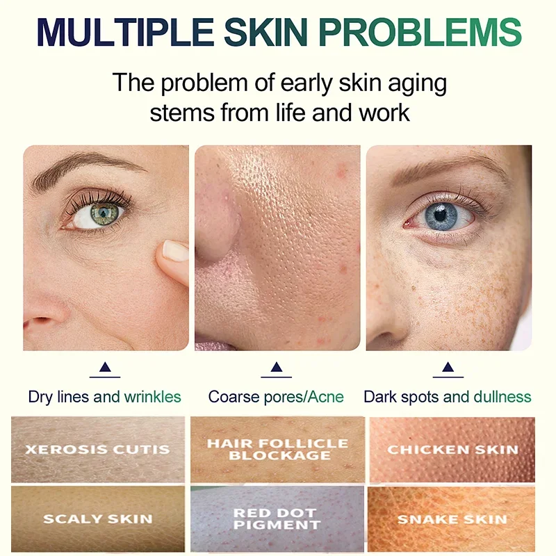 2ND Salicylic Acid Face Facial - Glycolic Acid Exfoliant recension och pris