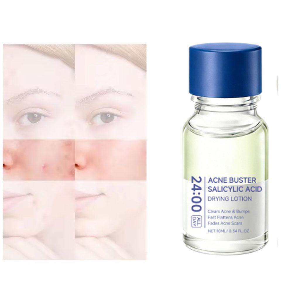 Salicylic Acid Essence Treatme - Tranexamic Acid Serum recension och pris