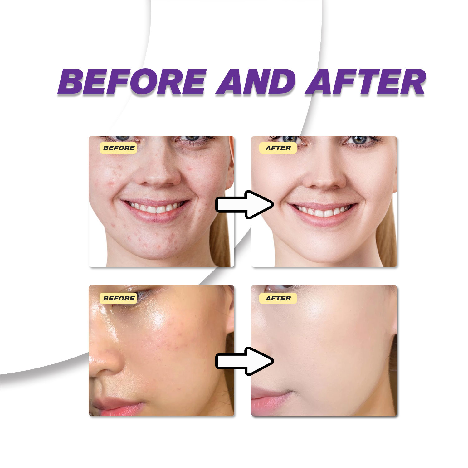 Mild Azelaic Acid Cream Improv - Azelaic Acid Serum recension och pris