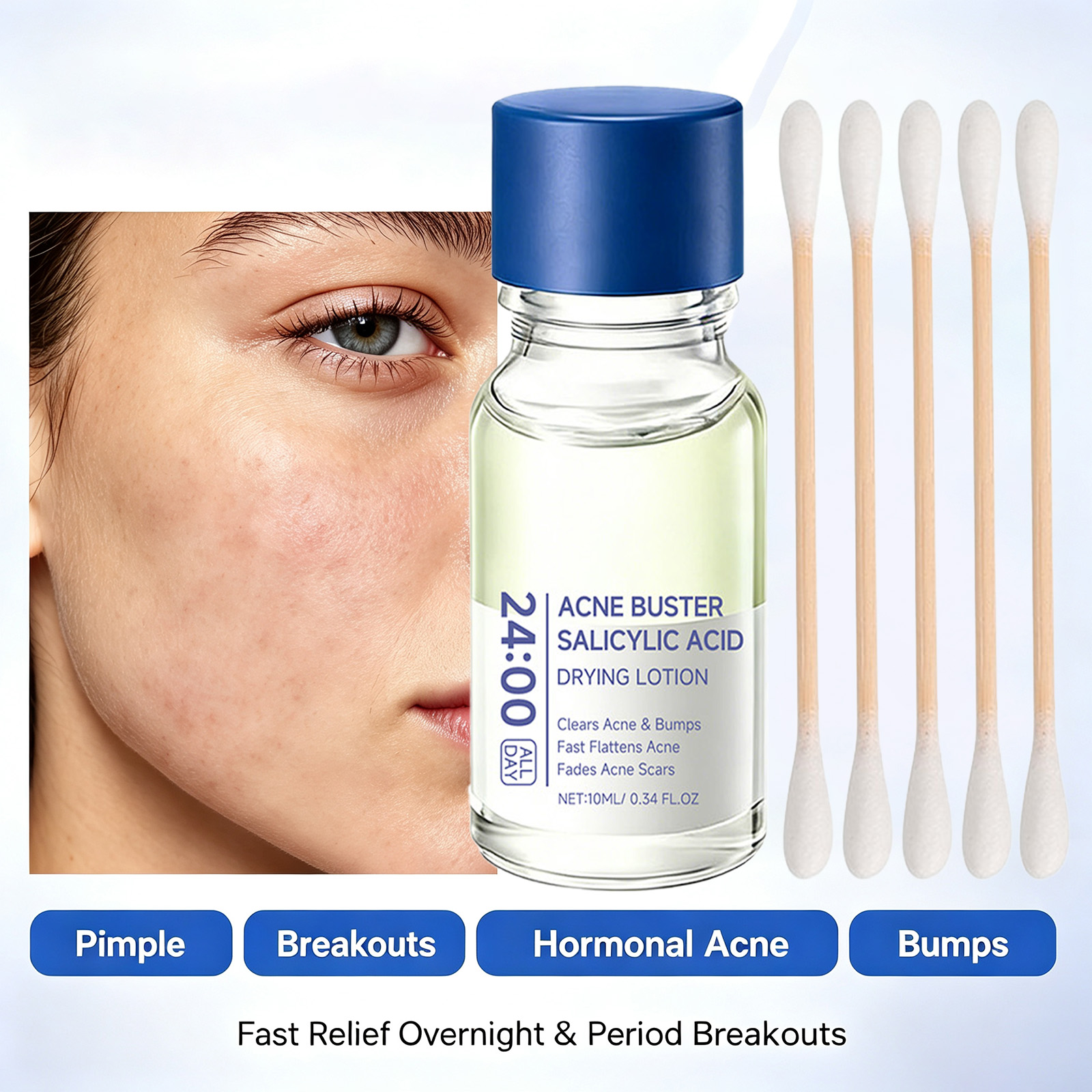 Salicylic Acid Acne Treatment  - Tranexamic Acid Serum recension och pris