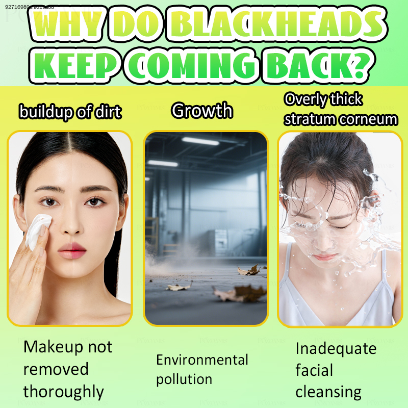 POZOAMIS Deep Pore Cleansing F - Skincare Oily Skin recension och pris