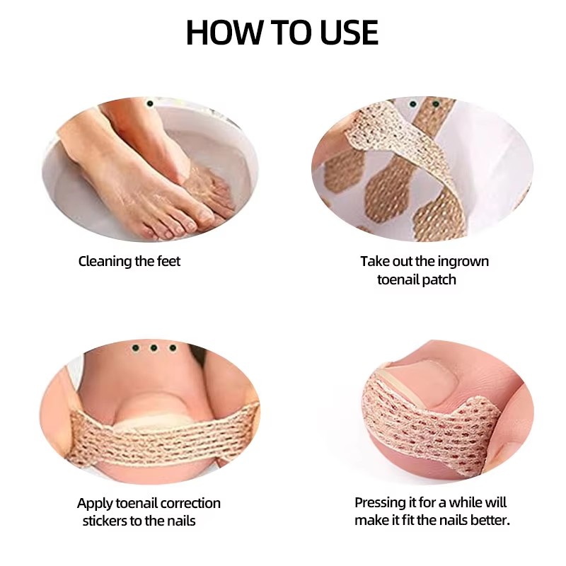 10-100Pcs Adhesive Toenail Pat - Skincare Oily Skin recension och pris