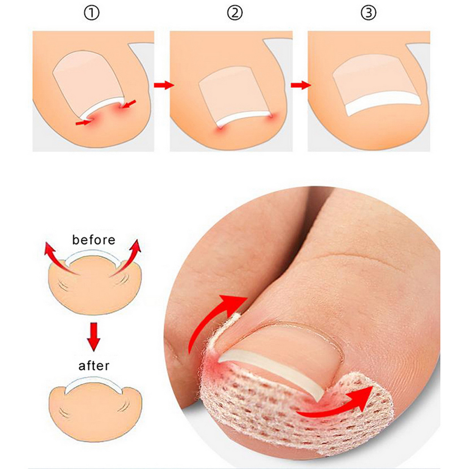 10-100Pcs Adhesive Toenail Pat - Skincare Oily Skin recension och pris