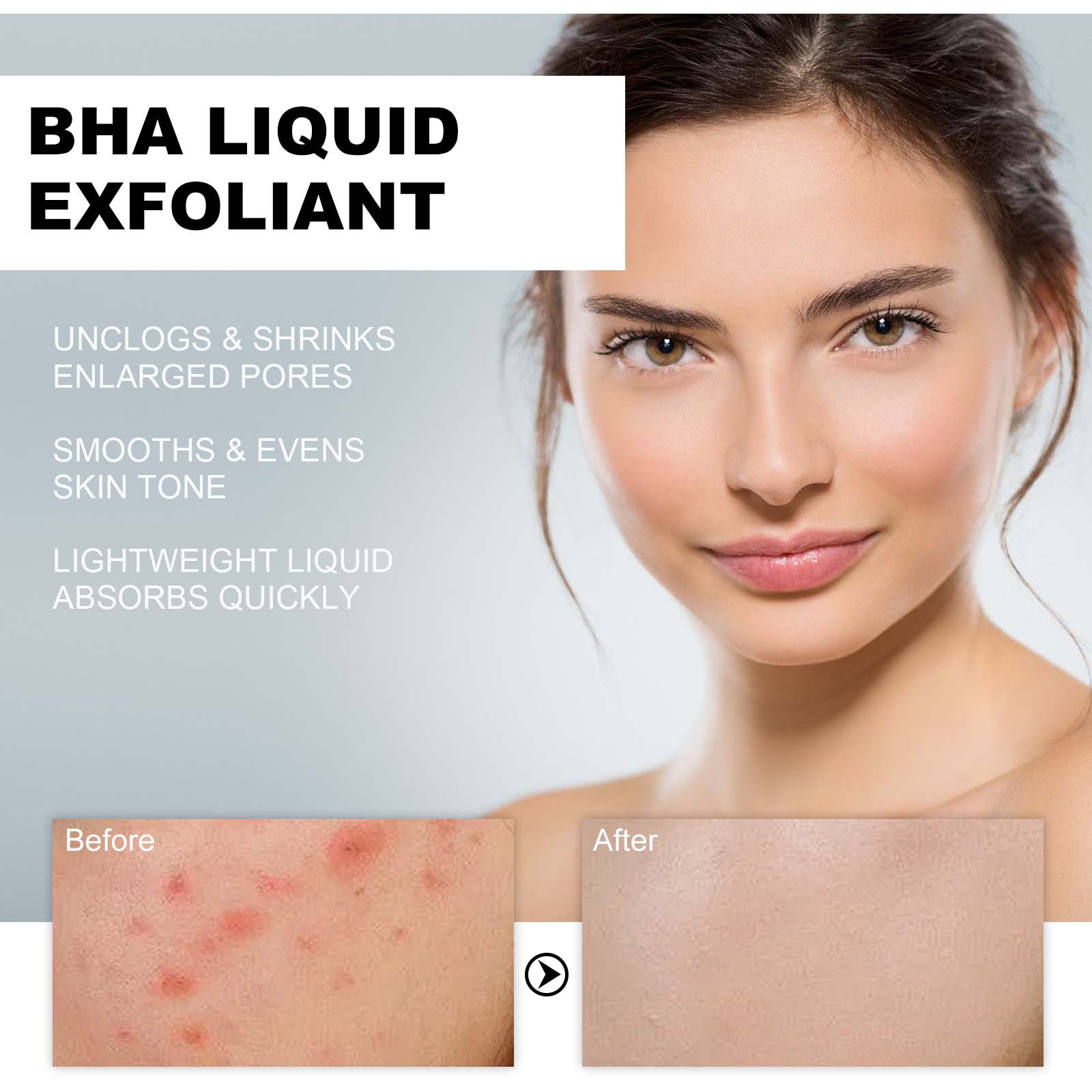 2% Salicylic Acid Liquid Exfol - Tranexamic Acid Serum recension och pris