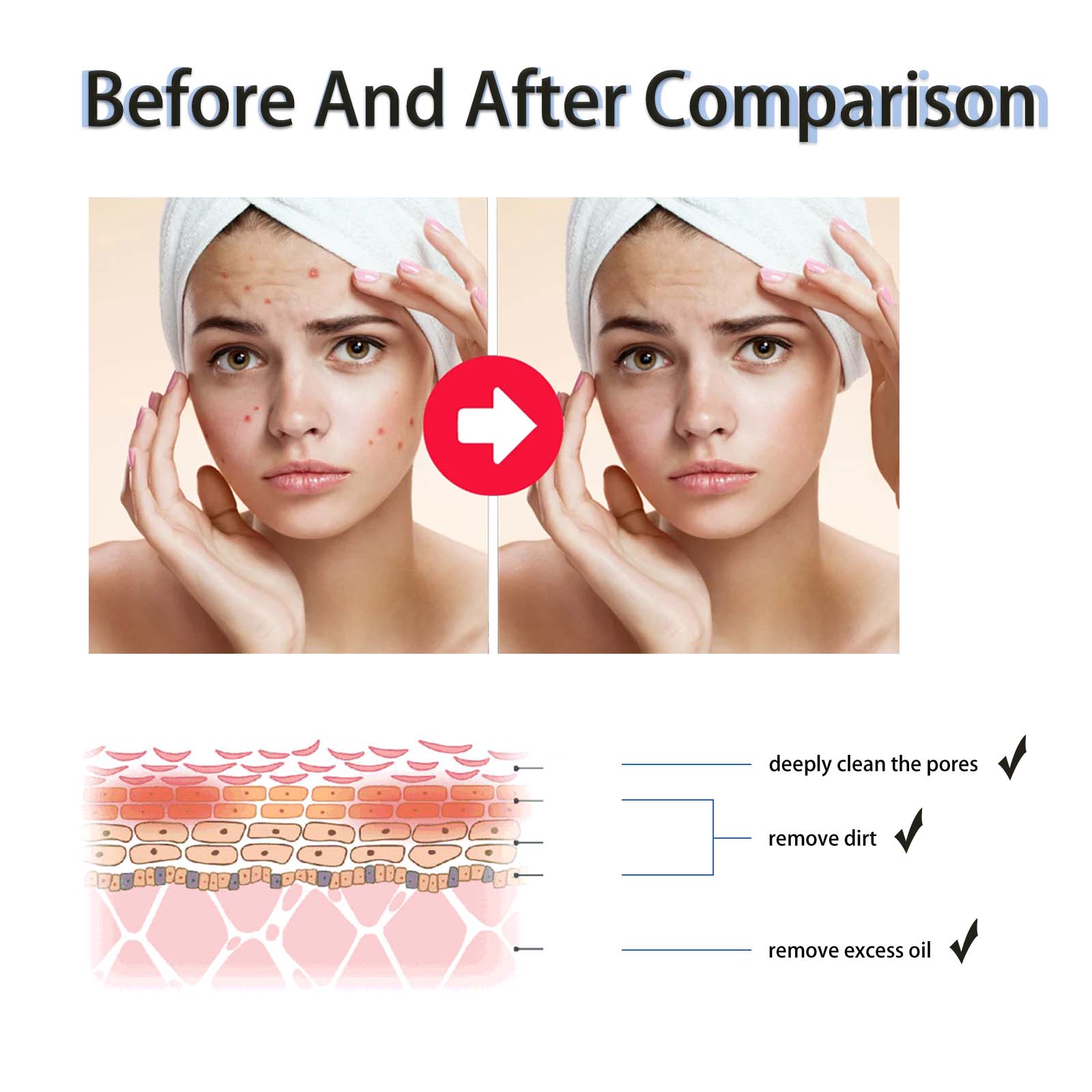 2% Salicylic Acid Liquid Exfol - Tranexamic Acid Serum recension och pris